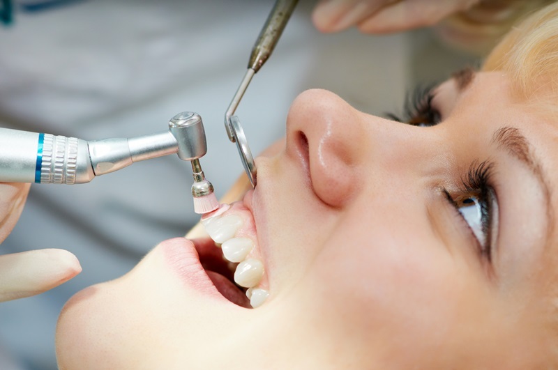 tooth removal